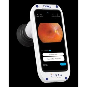 VISTAVIEW Ophthalmic Lens